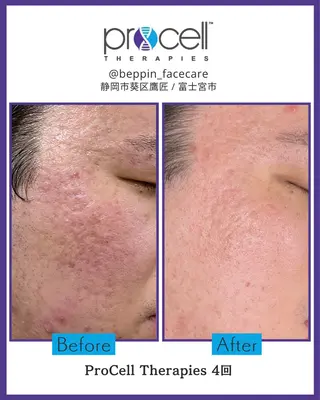 メンズ the 別嬪 静岡店所属・the 別嬪 静岡店のエステ・リラクイメージ