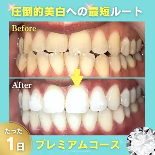 nomama ホワイトニング大宮店のエステ・リラクイメージ