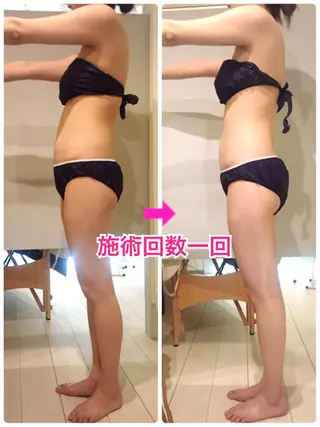 ショート カラー パーマ ヘアアレンジ メンズ ‍痩身＆ボディ 結果出し🌟丹野のエステ・リラクイメージ