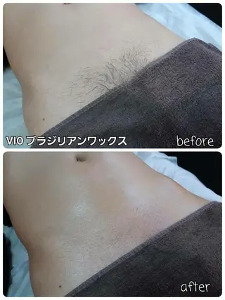 メンズ メンズ・脱毛サロン DEARS所属・山村幸久　メンズ脱毛 ディアーズのエステ・リラクイメージ