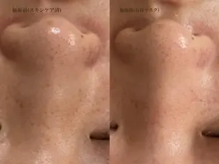 ナリスビューティースタジオデアイム倉敷所属・森口 美空のエステ・リラクイメージ