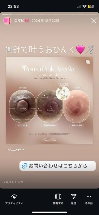 Monreve所属・美人スイッチdiet スーパージェクションのその他イメージ