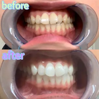 ホワイトニング専門店 LCS 汐留店 森田のその他イメージ