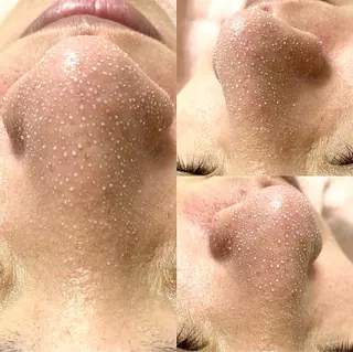 韓国式３D毛穴洗浄＆ 脱毛vive京橋のエステ・リラクイメージ