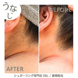 Hit. シュガーリング豊橋のエステ・リラクイメージ