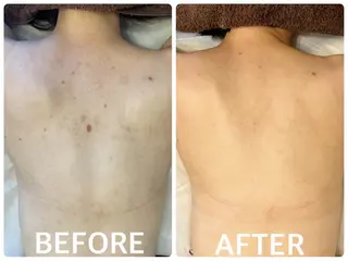 ハーブピーリング 横浜のエステ・リラクイメージ