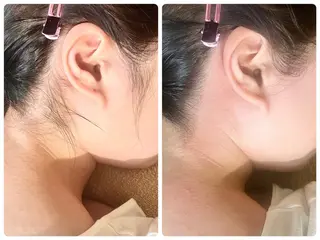 Nail & 高速脱毛 avenir【アヴニール】所属・WAX/眉/光脱毛 🌿リラク/小顔のエステ・リラクイメージ