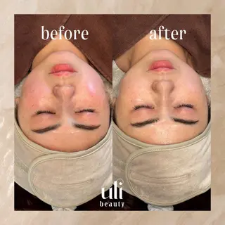 uli beauty所属・韓国肌管理サロン ulibeautyのエステ・リラクイメージ