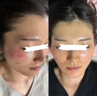 217whitening  room所属・217 ホワイトニングルームのエステ・リラクイメージ