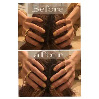 鍼灸整骨院Refine所属・鍼灸 Refineのその他イメージ