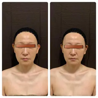 あるる所属・韓国式小顔矯正 担当ゆいのエステ・リラクイメージ