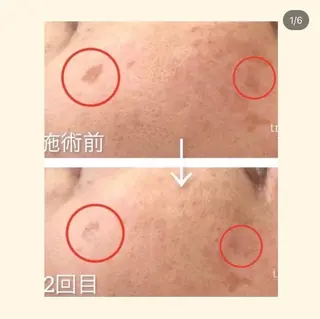 韓国肌管理 【毛穴専科】のエステ・リラクイメージ