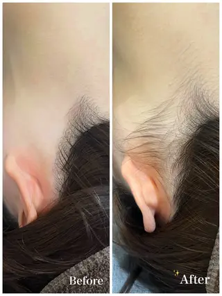 脱毛サロン fam.豊澤柚良のエステ・リラクイメージ