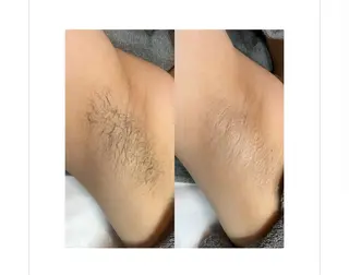 Bloom 池袋西口店〔ブルーム〕所属・池袋SATOMI🫧 完全度払い脱毛のエステ・リラクイメージ