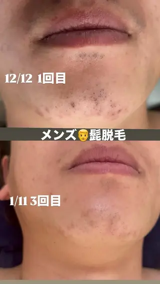 トータルビューティーサロンFirstclass所属・Firstclass Erikaのエステ・リラクイメージ