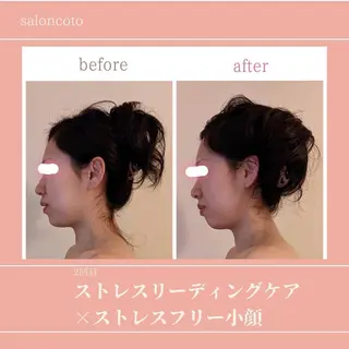 stress care salon　海と猫所属・小顔salon 古田琴のエステ・リラクイメージ