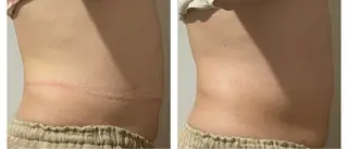 癒し腸もみサロン シャユーム　ゆきなのエステ・リラクイメージ