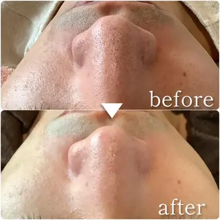 脱毛&エステサロン JIGGLY武蔵小山のエステ・リラクイメージ