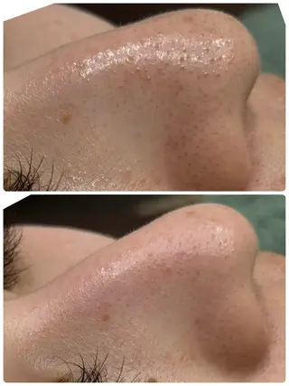 脱毛&フェイシャル 専門店muro.のエステ・リラクイメージ