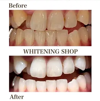 ホワイトニングショップ伊丹店所属・ホワイトニング ショップ伊丹店のその他イメージ