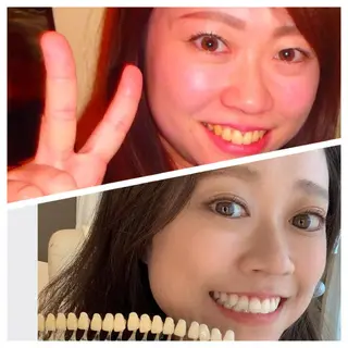 ライトビューティー千葉店所属・ホワイトニングジム 千葉駅前店のその他イメージ