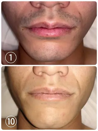 脱毛・眉毛・フェイス サロンN久留米店の眉毛・アイブロウイメージ