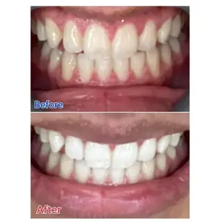 M渋谷店所属・Ｍ渋谷 ホワイトニングのエステ・リラクイメージ