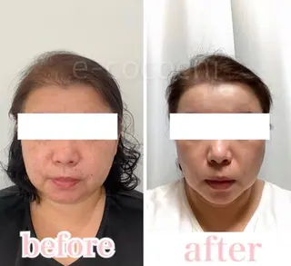 小顔と ヘッドスパのお店のエステ・リラクイメージ