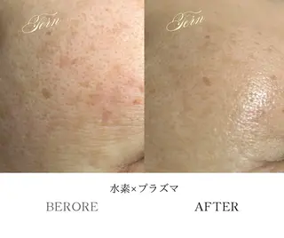 小顔・ニキビ・肌管理 TERN 南草津店のエステ・リラクイメージ