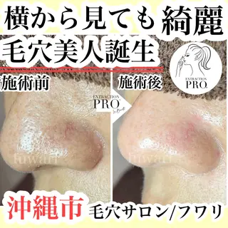 毛穴専門サロン　フワリ所属・島袋 聡子のエステ・リラクイメージ