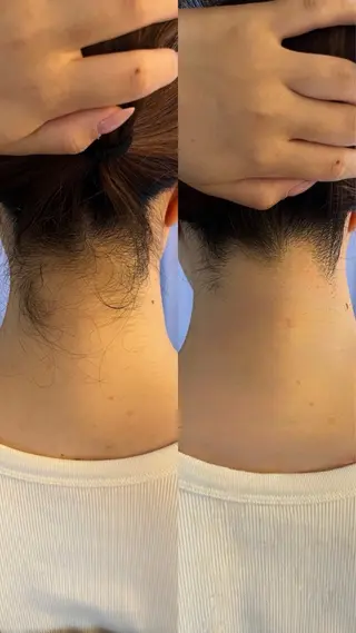 うなじ脱毛/美肌脱毛 LABELのエステ・リラクイメージ