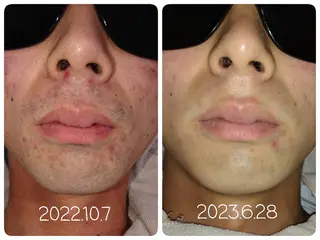 プライベートサロンマリン所属・Private Sa lon MARINEのエステ・リラクイメージ