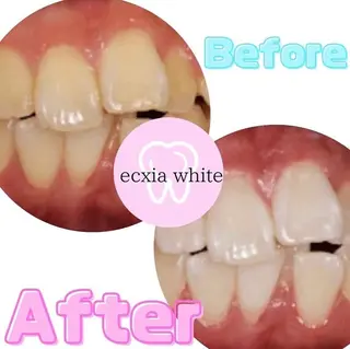 メンズ エクシアホワイトニング草津店所属・nanami -ホワイトニングのその他イメージ