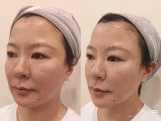 aliaハイフ&水光ジェットサロン所属・aliaハーブ水光店 エステティシャン募集のエステ・リラクイメージ