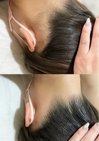 脱毛専門サロンElixir加須店所属・脱毛専門サロン Elixir　加須店のエステ・リラクイメージ