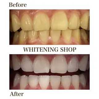 ホワイトニング ショップ銀座7丁目店のその他イメージ