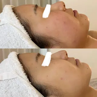 田中For..天王寺 肌質改善/よもぎ蒸しのエステ・リラクイメージ