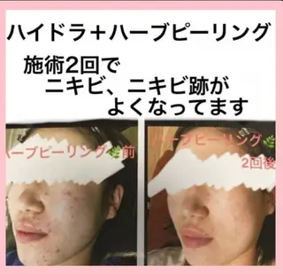 ハーブピーリング 専門店Kikkaのエステ・リラクイメージ