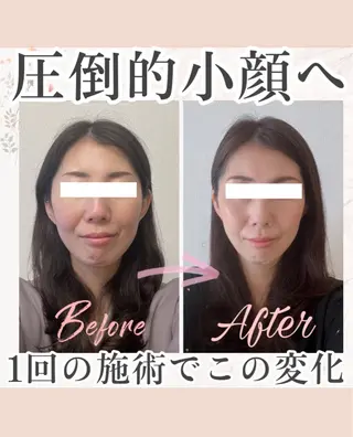 小顔矯正専門サロンAxiune所属・小顔矯正専門 🪽アシュネ平野のエステ・リラクイメージ