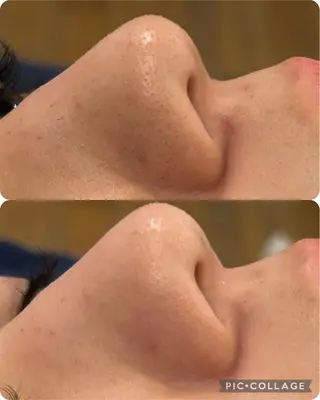 インディバサロン ソレイユ所属・indiba soleilのエステ・リラクイメージ