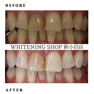 メンズ ホワイトニング ショップ新小岩店のその他イメージ