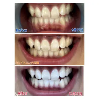 MBEAUTYSALON 千葉店・京成大久保所属・Melty 輝のその他イメージ