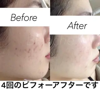 ショート カラー パーマ ヘアアレンジ キッズ ネイル マツエク・マツパ 都度払い肌質改善 &脱毛Blancheのエステ・リラクイメージ
