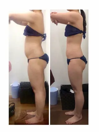 ハーブピーリングMB eautySalonのエステ・リラクイメージ