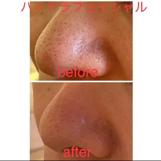 プリート毛穴洗浄美肌 Pulitoのエステ・リラクイメージ