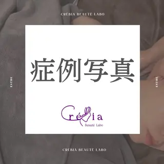 小顔＆まつ毛サロン AKANE❤️のエステ・リラクイメージ