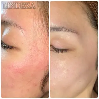 private salon 𝐋𝐈𝐍𝐃𝐄𝐙𝐀所属・LINDEZA Ayaのエステ・リラクイメージ