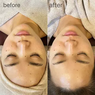 MiEL total beauty salon所属・Rie ×MiELのエステ・リラクイメージ