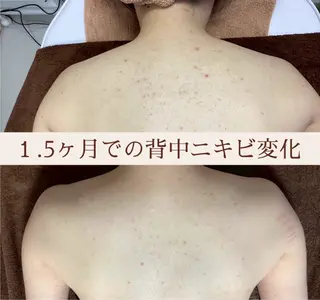 都度払い 肌質改善専門サロンのエステ・リラクイメージ