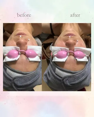 Belle ＋vi（ベル）のその他イメージ